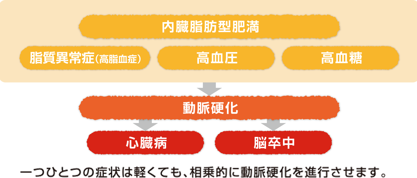 脳卒中や心臓病の原因となるメタボリックシンドローム